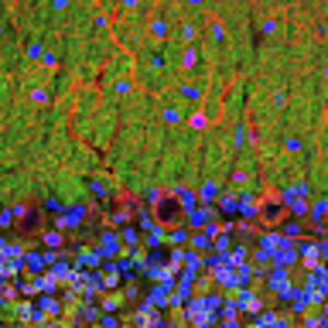 Meet your Posher, Lyndie